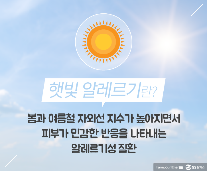 햇빛 알레르기란